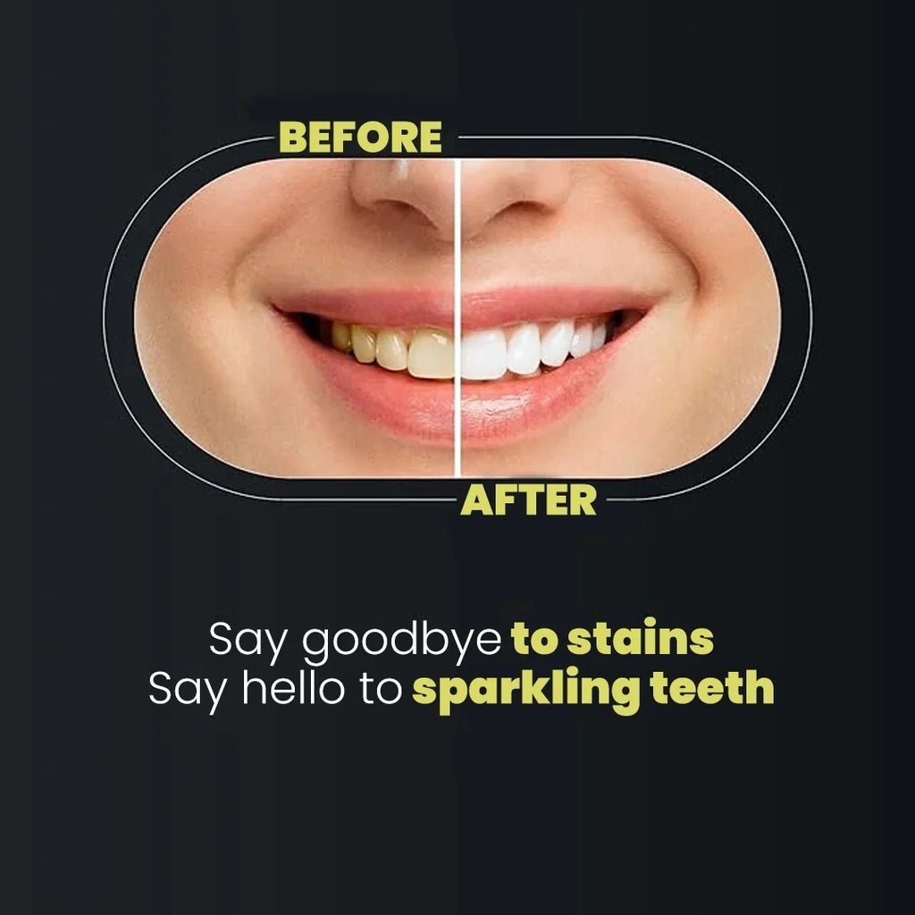 Teeth Whitening Strips 3D Gentle Stain Removing Enamel Safe Bright Smile Daily Treatment 14 Strips